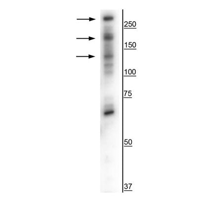 1 - Anti-CaSR Antibody AN1327