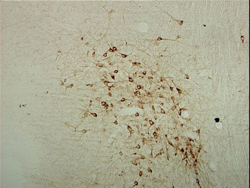 2 - Anti-ChAT (Choline Acetyltransferase) Antibody AN1334