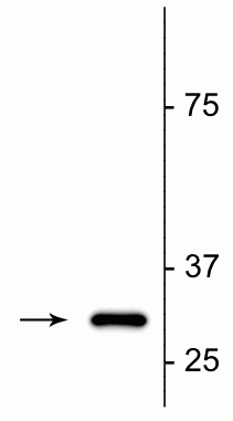 1 - Anti-Fractin Antibody AN1388
