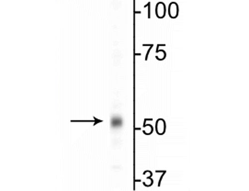 1 - Anti-GABAA Receptor ß1 Antibody AN1398