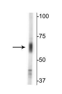 1 - Anti-GABA Transporter (GAT) 2 Antibody AN1409