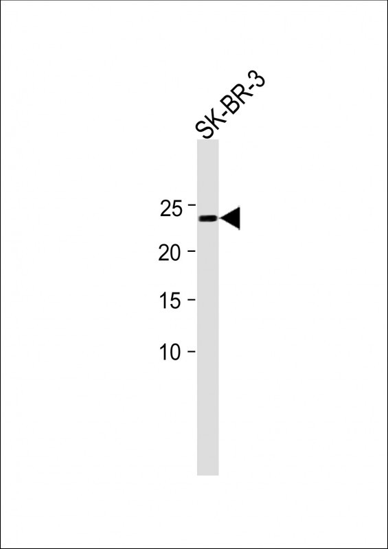 1 - SRTD3 Antibody  (N-term) AP5927a