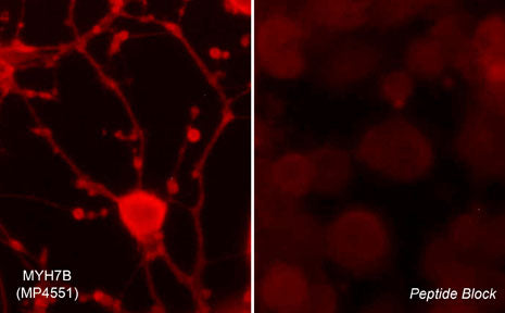2 - Anti-Myosin 7B/MHC14 (Hinge region) Antibody AN1848