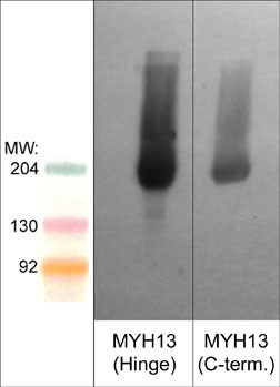 1 - Anti-Myosin 13/Extraocular Myosin (C-terminal region) Antibody AN1849