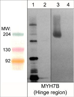 1 - Anti-Myosin 7B/MHC14 (Hinge region) Antibody AN1848