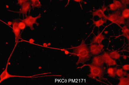 2 - Anti-PKCθ (N-terminal region) Antibody AN1908