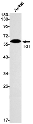 1 - DNA Nucleotidylexotransferase Rabbit mAb AP74812