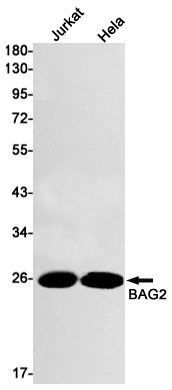 1 - BAG2 Rabbit mAb AP74842