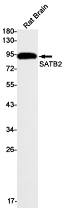 1 - SATB2 Rabbit mAb AP74895