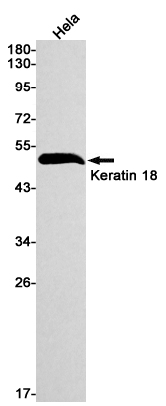 1 - Cytokeratin 18 Rabbit mAb AP74945