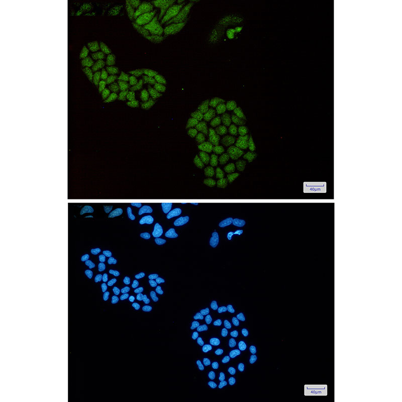 1 - ENO1 Rabbit mAb AP74980