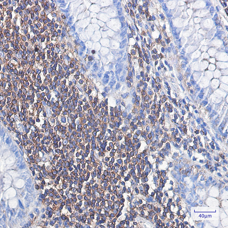 5 - alpha Skeletal Muscle Actin Rabbit mAb AP74987