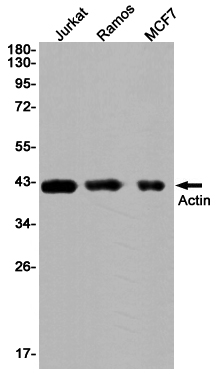 2 - alpha Skeletal Muscle Actin Rabbit mAb AP74987