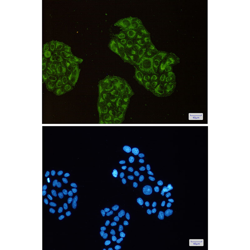 1 - ACADM Rabbit mAb AP75023