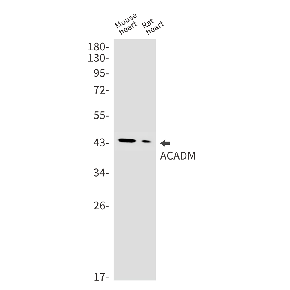 1 - ACADM Rabbit mAb AP75023