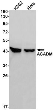 3 - ACADM Rabbit mAb AP75023