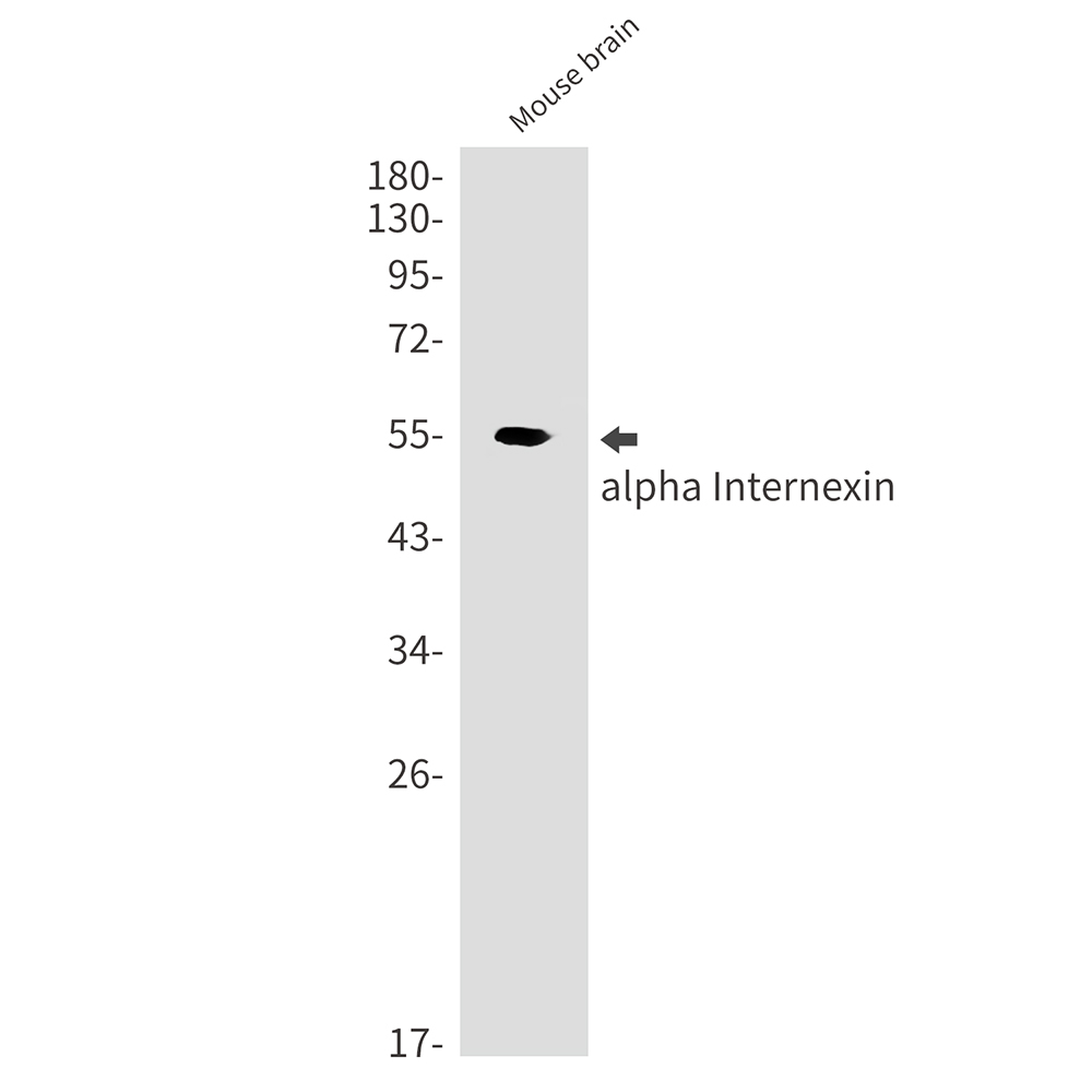 1 - alpha Internexin Rabbit mAb AP75062