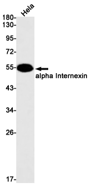 1 - alpha Internexin Rabbit mAb AP75062