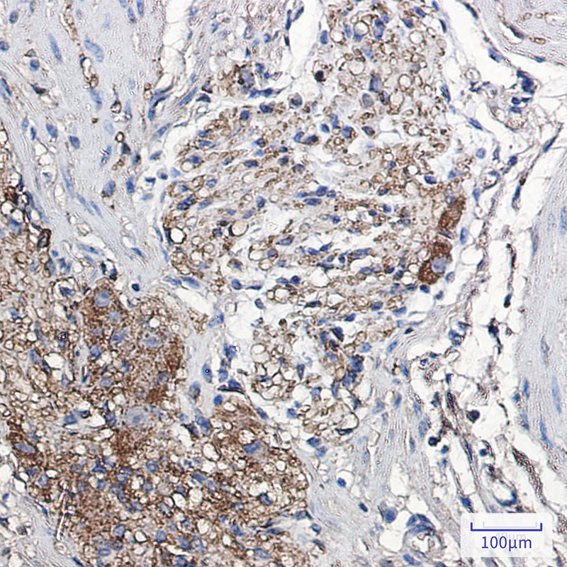 2 - alpha Synuclein Rabbit mAb AP75067
