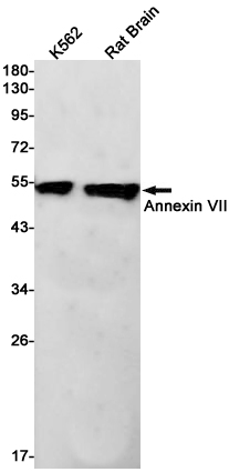 1 - Annexin VII Rabbit mAb AP75080