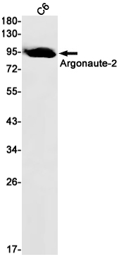 1 - Argonaute 2 Rabbit mAb AP75101