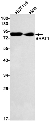 1 - BRAT1 Rabbit mAb AP75166