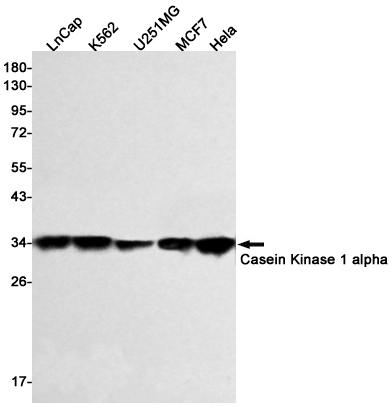 1 - Casein Kinase 1 alpha Rabbit mAb AP75190