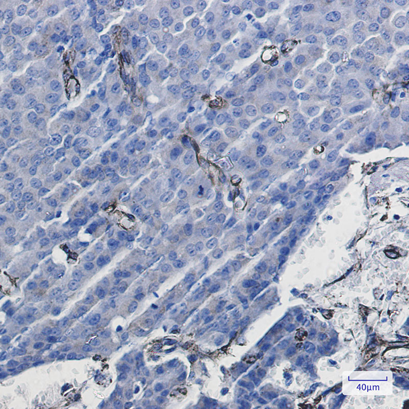 2 - Caveolin 1 Rabbit mAb AP75203