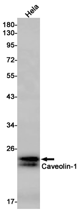 1 - Caveolin 1 Rabbit mAb AP75203
