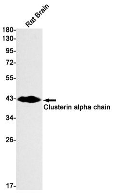 1 - Clusterin alpha Chain Rabbit mAb AP75274