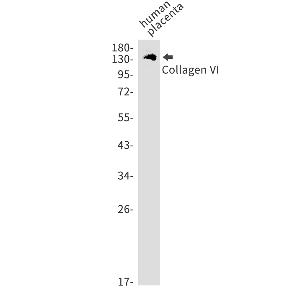 1 - Collagen VI alpha 1 Rabbit mAb AP75278