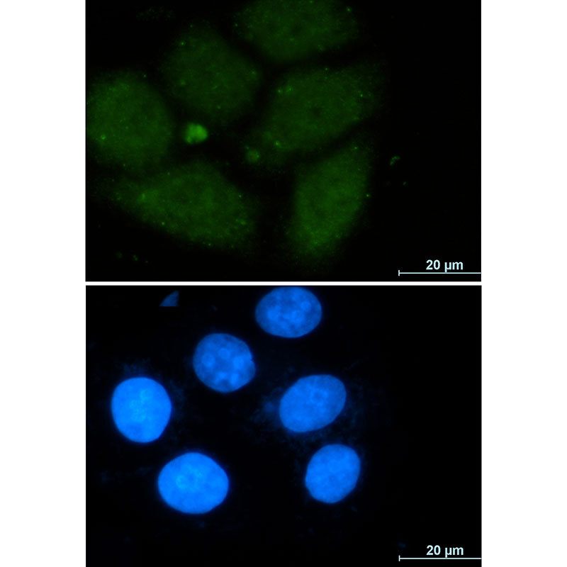 1 - CRM1 Rabbit mAb AP75293