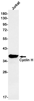 1 - Cyclin H Rabbit mAb AP75316