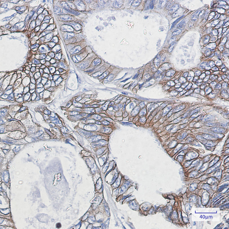 2 - Cytokeratin 18 Rabbit mAb AP75327