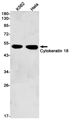 1 - Cytokeratin 18 Rabbit mAb AP75327