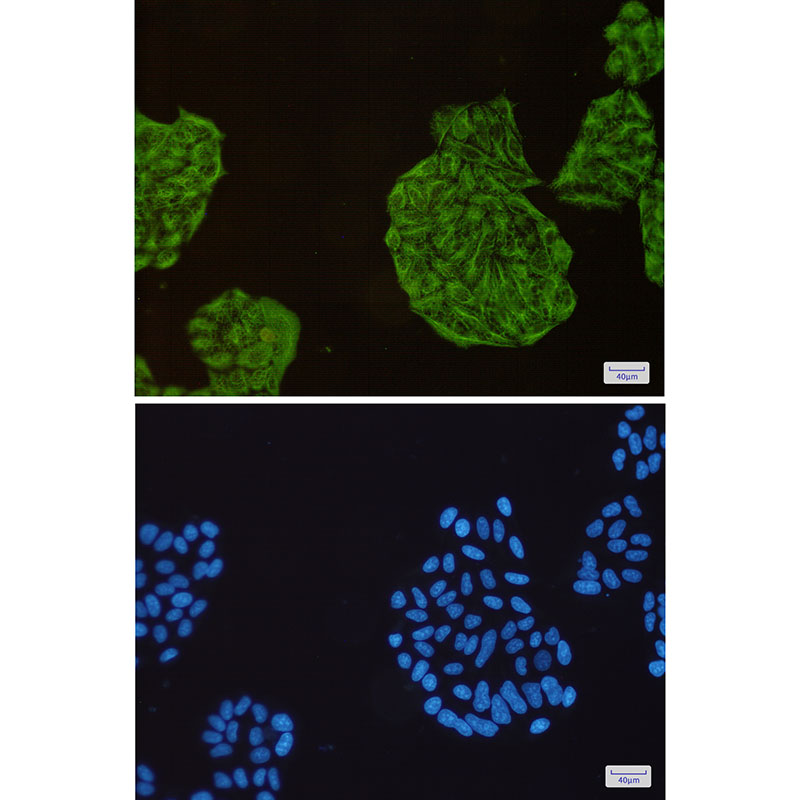 3 - Cytokeratin 18 Rabbit mAb AP75329