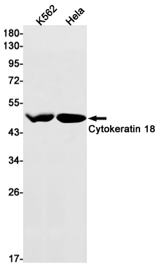 1 - Cytokeratin 18 Rabbit mAb AP75329