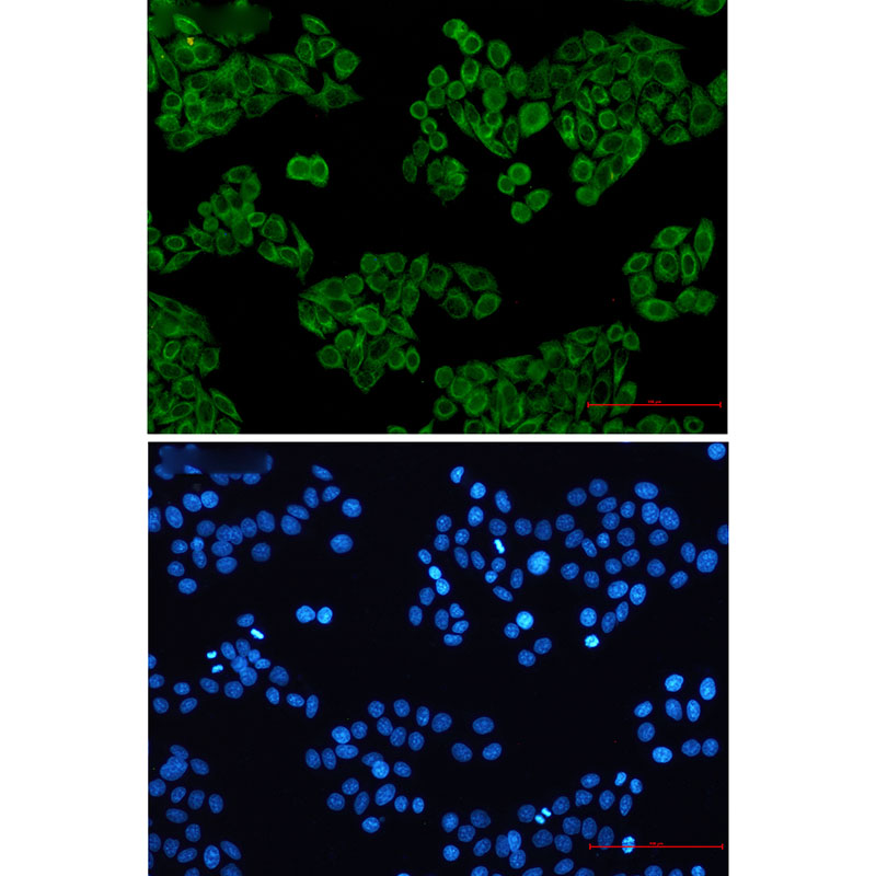 3 - Cytokeratin 7 Rabbit mAb AP75332