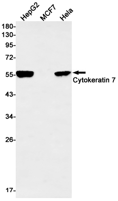 1 - Cytokeratin 7 Rabbit mAb AP75332