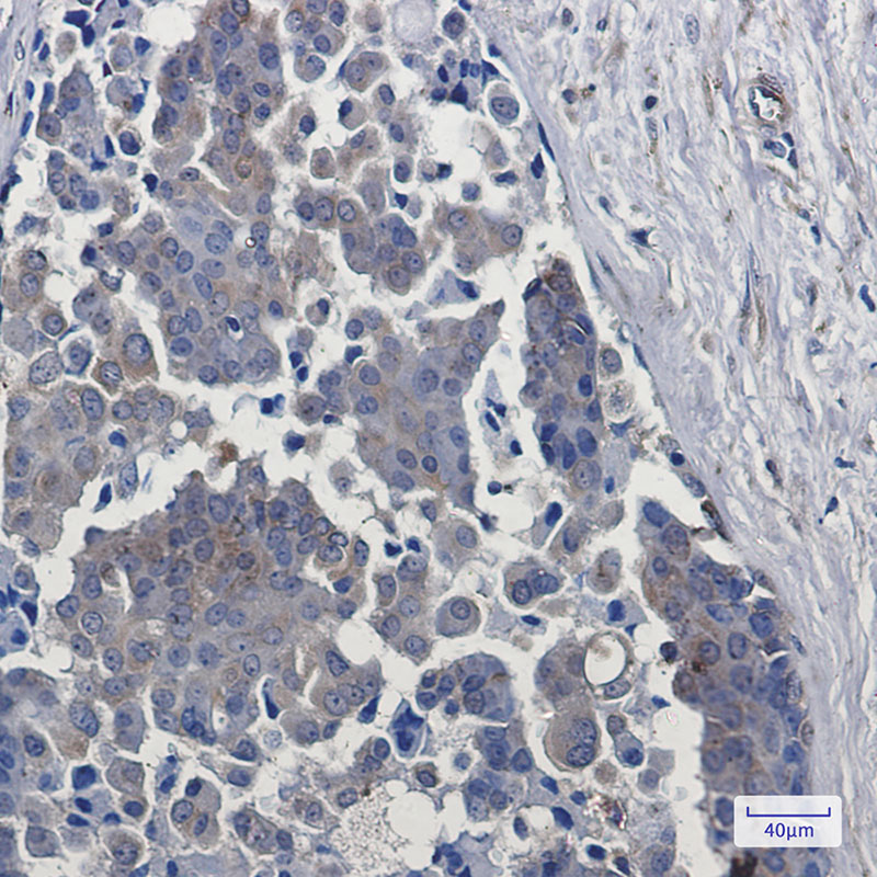 2 - EGFR Rabbit mAb AP75380