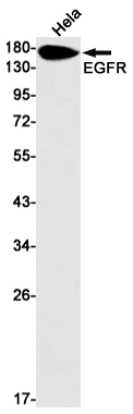1 - EGFR Rabbit mAb AP75380