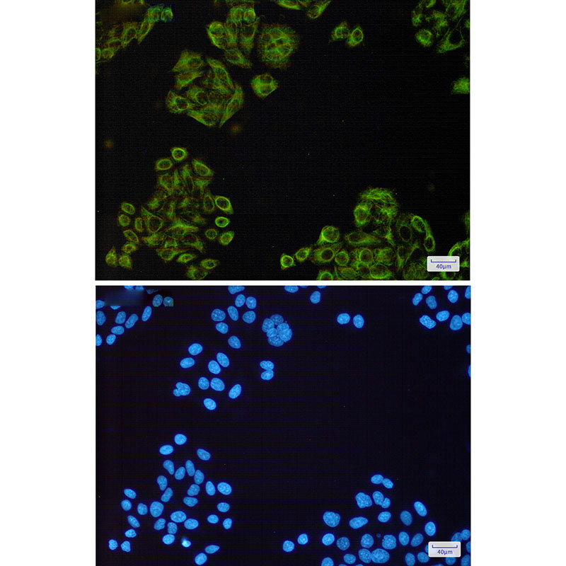 3 - EGFR Rabbit mAb AP75381