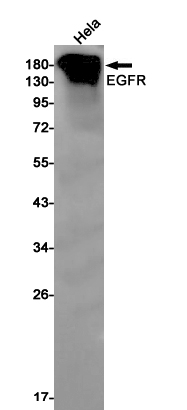 1 - EGFR Rabbit mAb AP75381