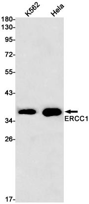 1 - ERCC1 Rabbit mAb AP75410