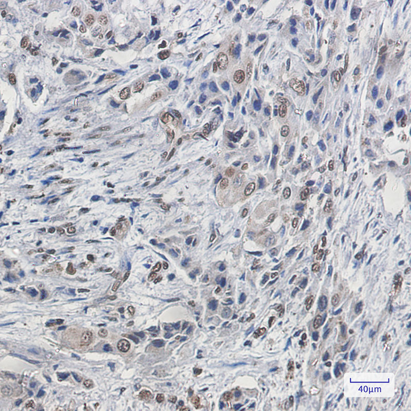 2 - FBP1 Rabbit mAb AP75428