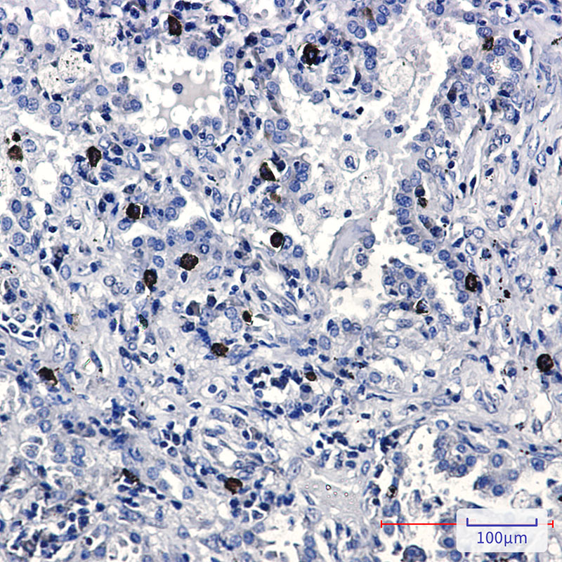 2 - FLI1 Rabbit mAb AP75442