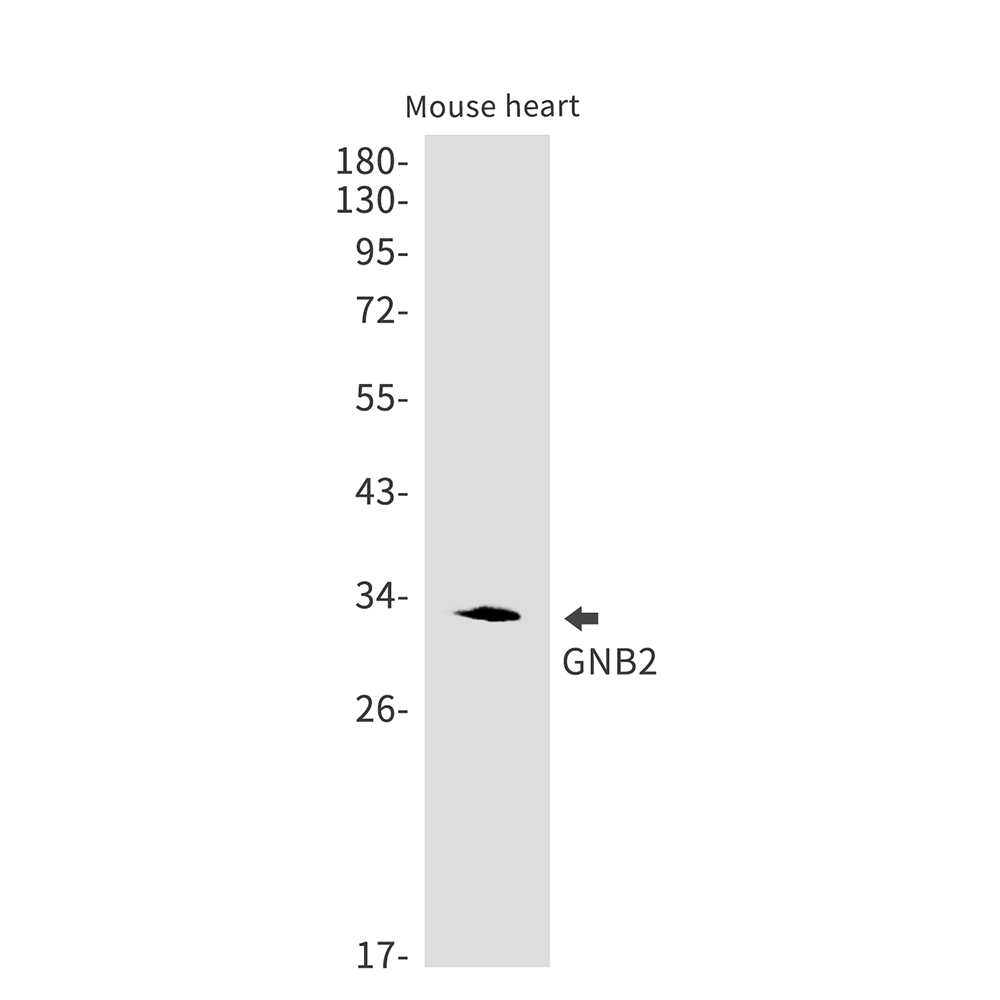 1 - GNB2 Rabbit mAb AP75509