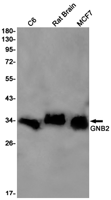 3 - GNB2 Rabbit mAb AP75509