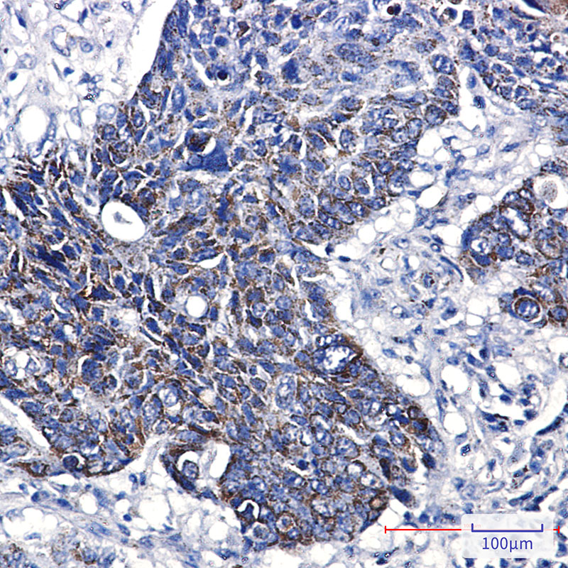 2 - GST3 Rabbit mAb AP75522