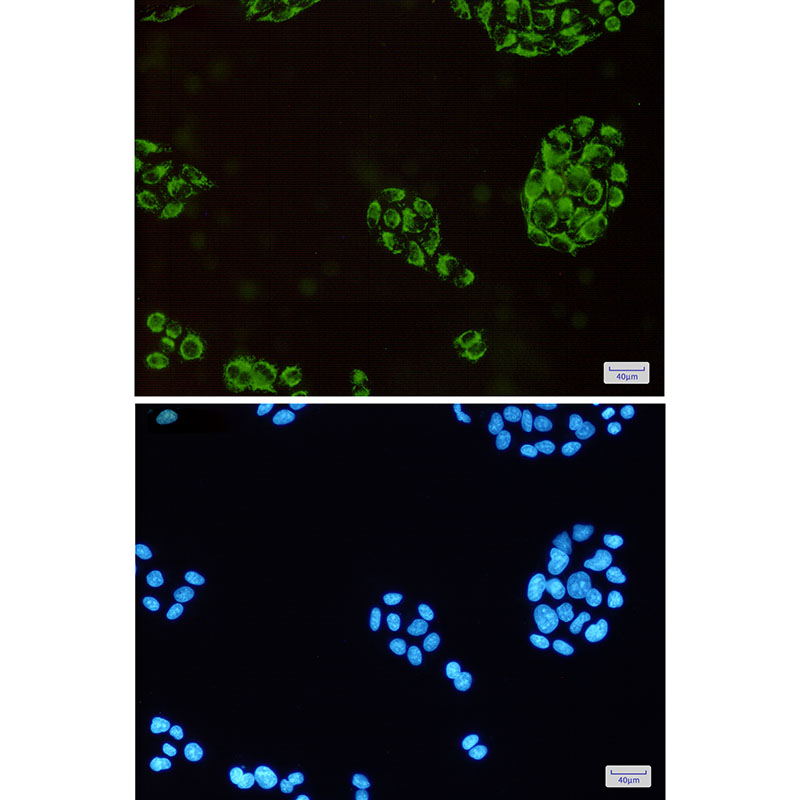 3 - HADHA Rabbit mAb AP75525